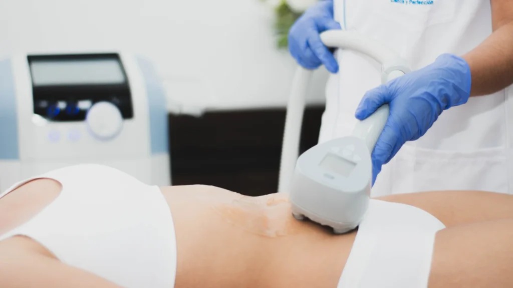 Exilis - Manejo de Equipos - Newbody